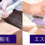 【徹底解説】『医療脱毛ＶＳ美容脱毛』あなたはどっち派？？