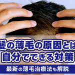 【必読】「薄毛の悩みを解消！タイプ別まとめ」