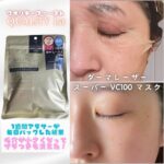 【最新トレンド】ダーマレーザーシートの効果が凄まじかった